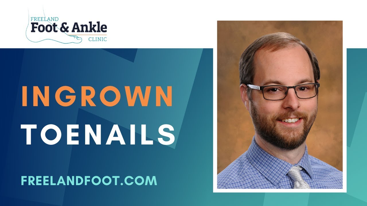Treatment for Ingrown Toenails | Freeland Foot & Ankle Clinic