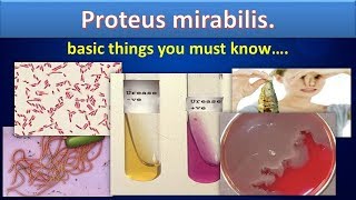 Proteus mirabilis(simply, clear overview)#Proteusmirabilis#Microbiology#MLS