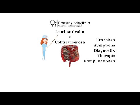 Morbus Crohn & Colitis ulcerosa