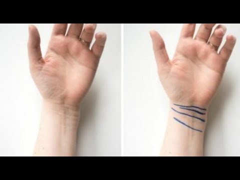 Thonë se nëse shikon ndonjë shenjë në dorë do të vdesë një njeri! Sa e vërtetë është?