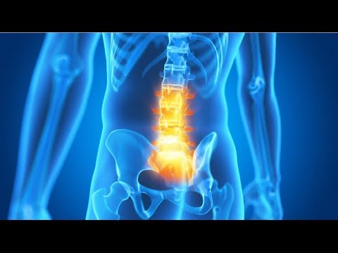 Dolori alle articolazioni di spalla con le braccia alzate Esercizio Video per le articolazioni