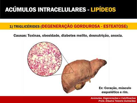 Aula 04 - Acúmulos, Pigmentos e Calcificações (PARTE I)