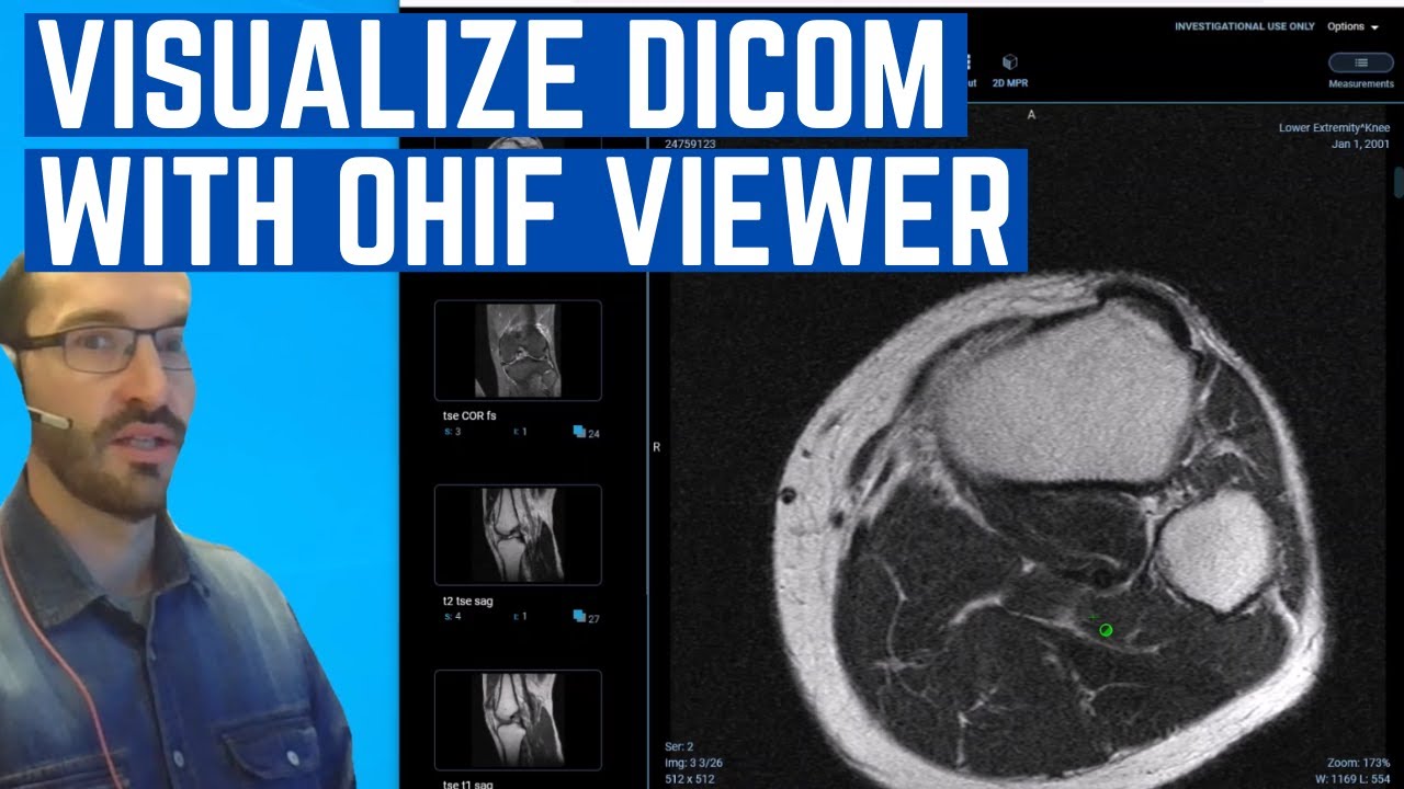 How to Install the OHIF web based DICOM viewer in Docker and connect it to DCM4CHEE