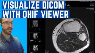 How to Install the OHIF web based DICOM viewer in Docker and connect it to DCM4CHEE