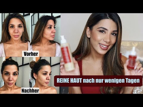 REINE HAUT nach wenigen Tagen mit Wow Effekt I ich habe es  getestet  I Soraya Ali