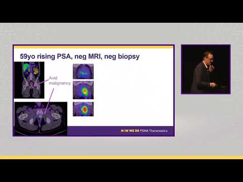 Will PSMA PET replace mpMRI for diagnosis of prostate ...