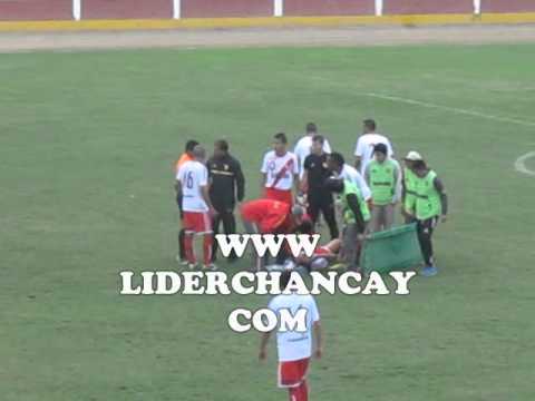 SEGUNDA 2014: Coopsol de Chancay 5 - Alfonso Ugarte de Puno 0