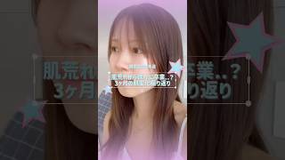 肌荒れから脱出したい韓国在住日本人の記録🫧 #VT #レチナールペプチド #肌管理 #韓国スキンケア #韓国在住日本人