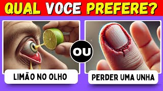 Qual Você preferiria...?  Escolhas mais difíceis de todos os tempos! 😱😨PARTE 2