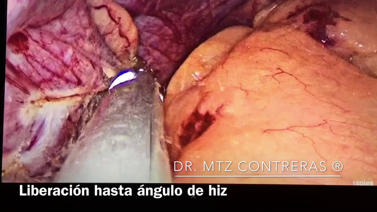 Arturo Martínez Contreras-14