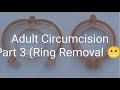 Shang Ring Circumcision Pt 3 Ring Removal