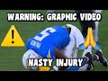 Joshua Palmer ‘SCARY’ KNEE INJURY! 🚨 WARNING: GRAPHIC! ⚠️ Chargers Vs Bears 2023 highlights