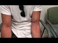 Results after Distal Biceps Repair in a MMA Fighter by Dr Mora