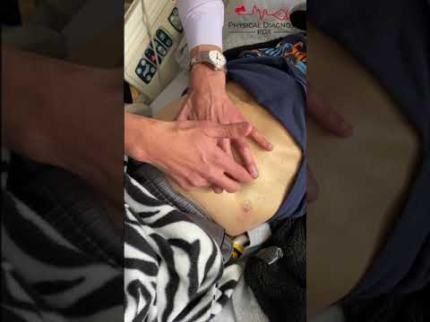 Shifting Dullness to Detect Ascites