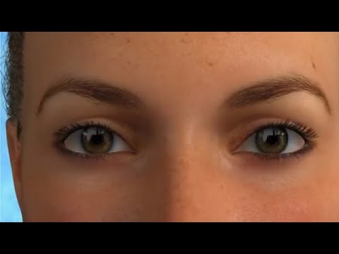 Blepharoplasty Animation