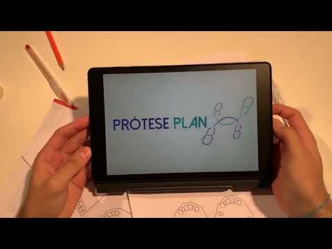 Protese Plan