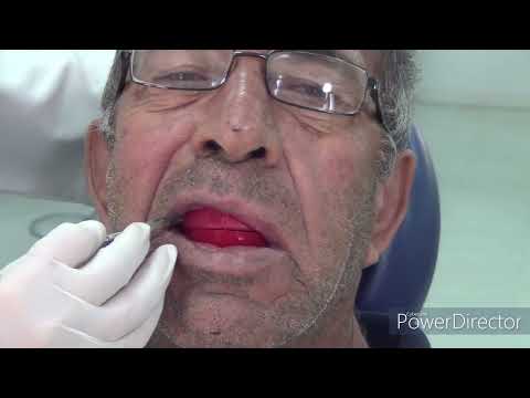 Clinical Steps for JRR