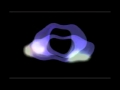 L Accidenatlly Omation