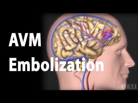 Overview of the Nervous System Animation