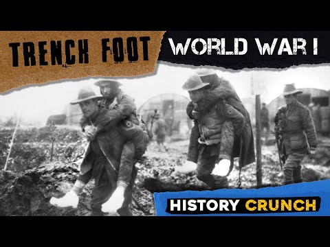 Trench Foot in World War 1 - Video Infographic