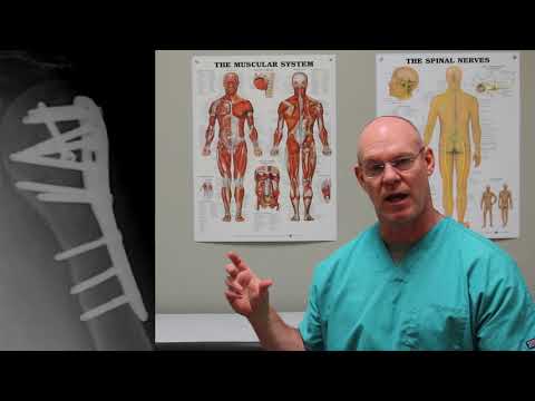 Proximal Humerus Fractures | Fracture Friday Episode 34