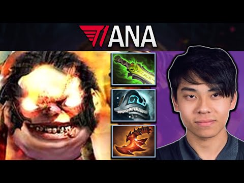 Pudge Dota 2 Gameplay T1.Ana with 23 Kills and Aghanims - Refresher