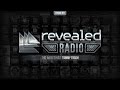 Revealed Radio 007 - Hosted By Tommy Trash ...