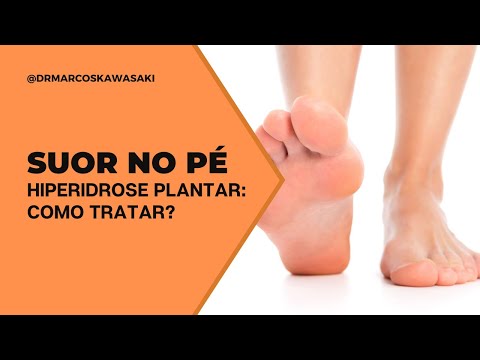 Suor no pé (hiperidrose plantar): como tratar?