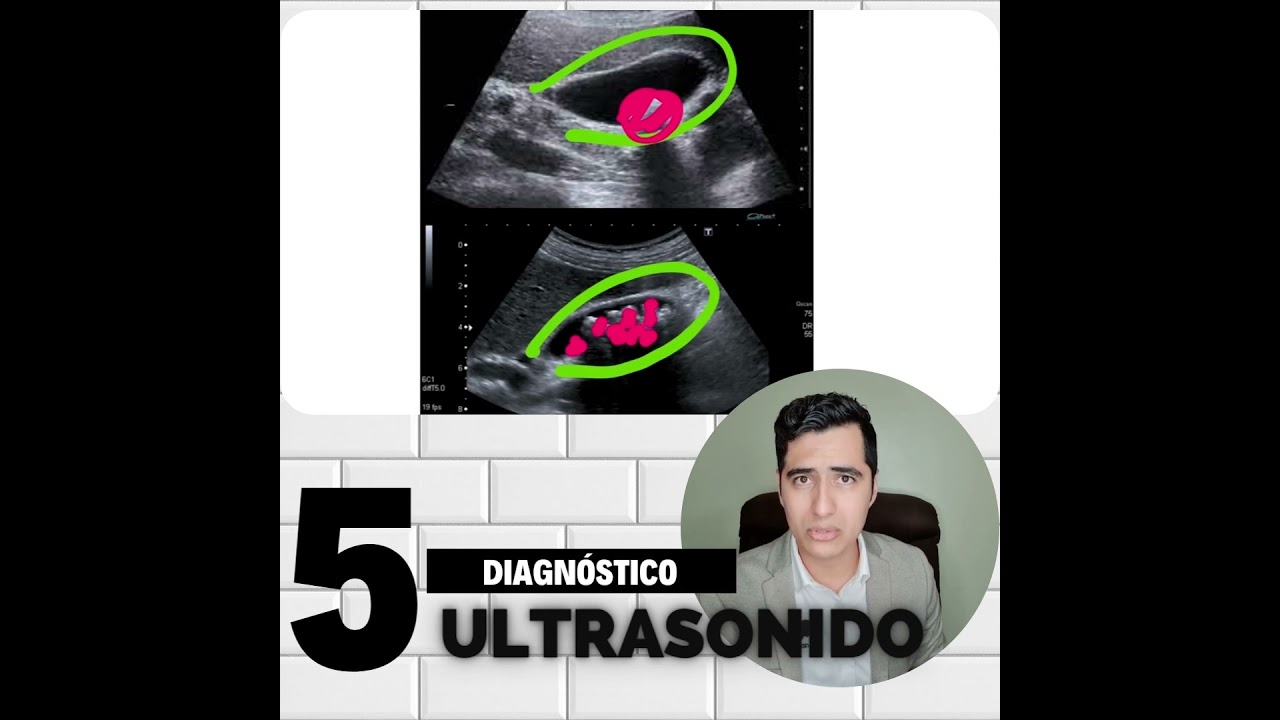 Jorge Alberto Hernández García-4