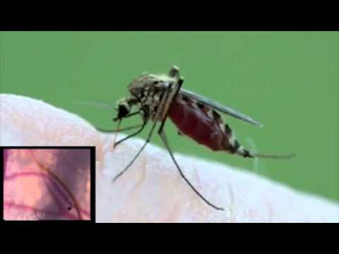 Piqûre de moustique en gros plan et vue au microscope