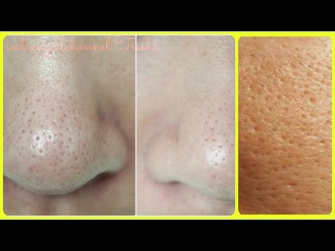 Get Rid of Large Pores/ 4 best remedy/ Get Smooth, Tighter,Younger Looking Skin Video