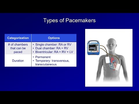 image-Who makes the best pacemakers?