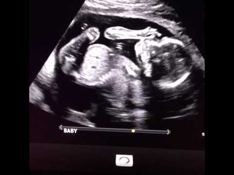 David 19 week ultrasound