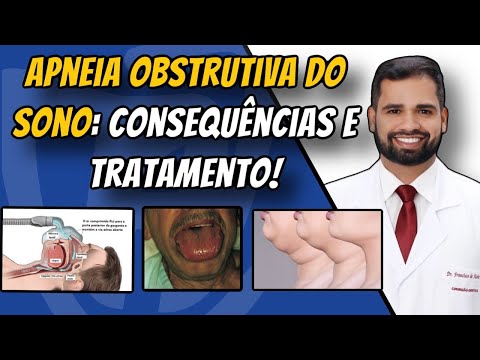 Francisco De Assis Almeida Lima Júnior-125