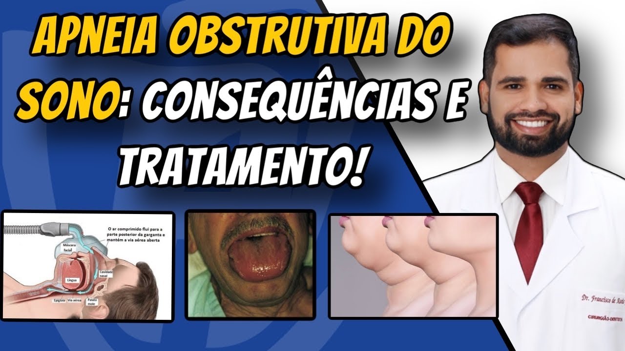 Francisco De Assis Almeida Lima Júnior-125