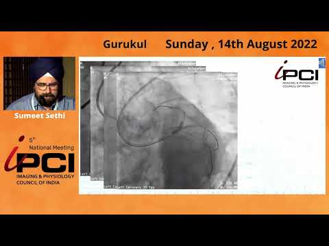 DR. SUMEET SETHI- OCT GUIDED LEFT MAIN BIFURCATION STENTING