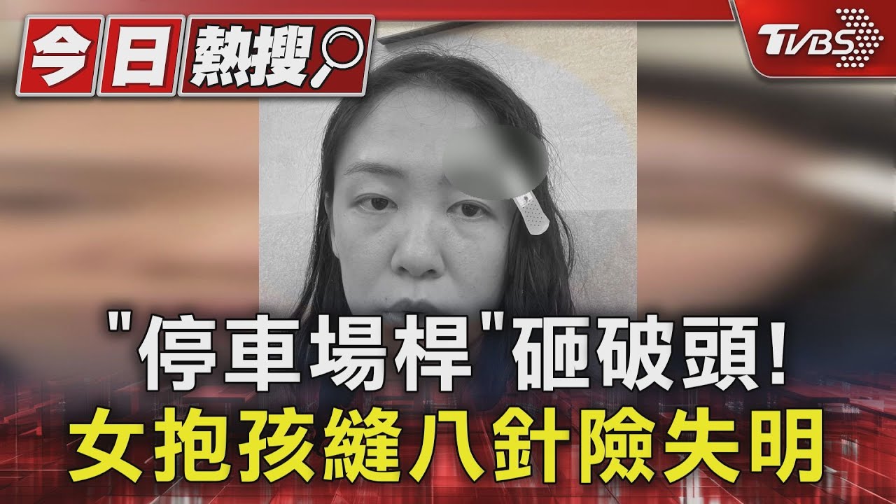 「停車場桿」砸破頭! 女抱孩縫八針險失明