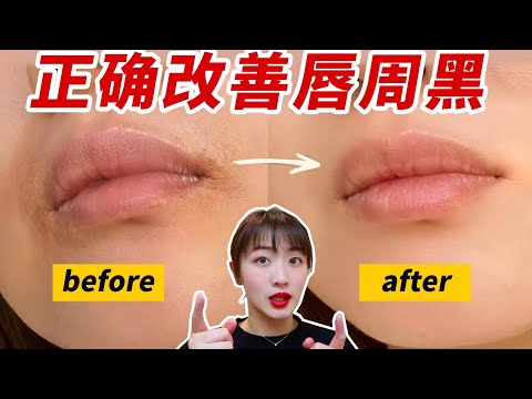 嘴角白