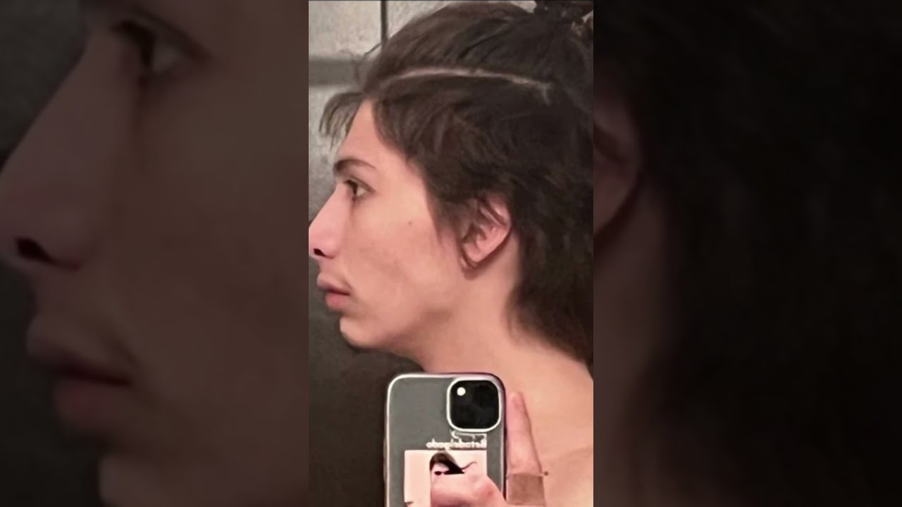 A few months mewing progress #mewing