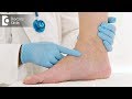 How Severe Are Blood Clots Dr Anand R Shenoy