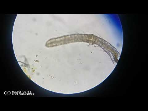A Detritus worm at 100x magnification