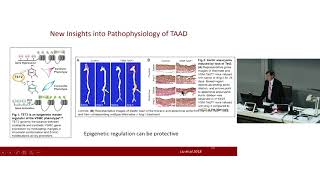 Genotypes in the Aorta & Aortic Valve – Prof Richmond Jeremy