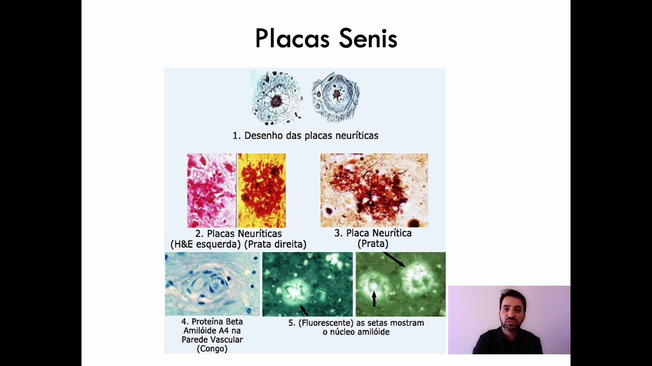 Modificações fisiológicas com o envelhecimento do sistema neurológico - Sistema Nervoso Central
