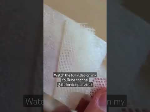 Jelonet is a non adherent wound dressing.