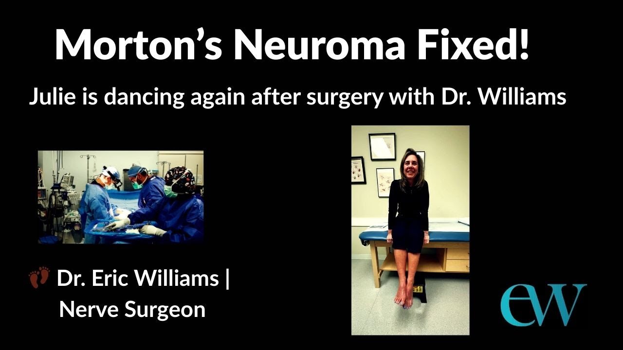 Morton’s Neuroma Surgery Success | Dr. Eric Williams Patient Story