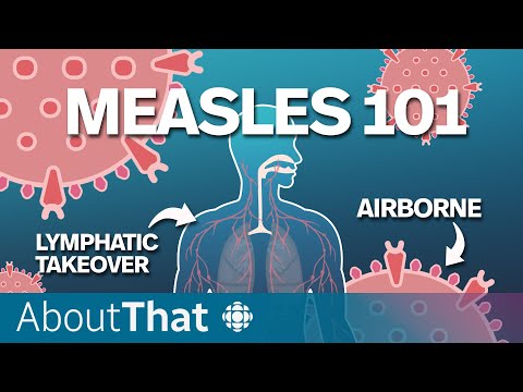 Measles: Understanding the most contagious preventable disease | About That