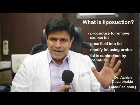 download lagu mp3 mp4 Liposuction Cost In India, download lagu Liposuction Cost In India gratis, unduh video klip Liposuction Cost In India
