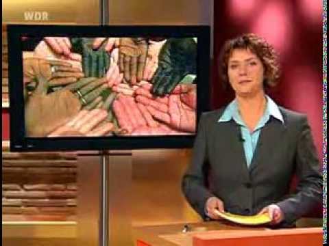Die Diät bei atopitscheskom die Hautentzündung für die Kinder 10 Jahre Das Menü des Kindes das 1 Jahr bei atopitscheskom die Hautentzündung