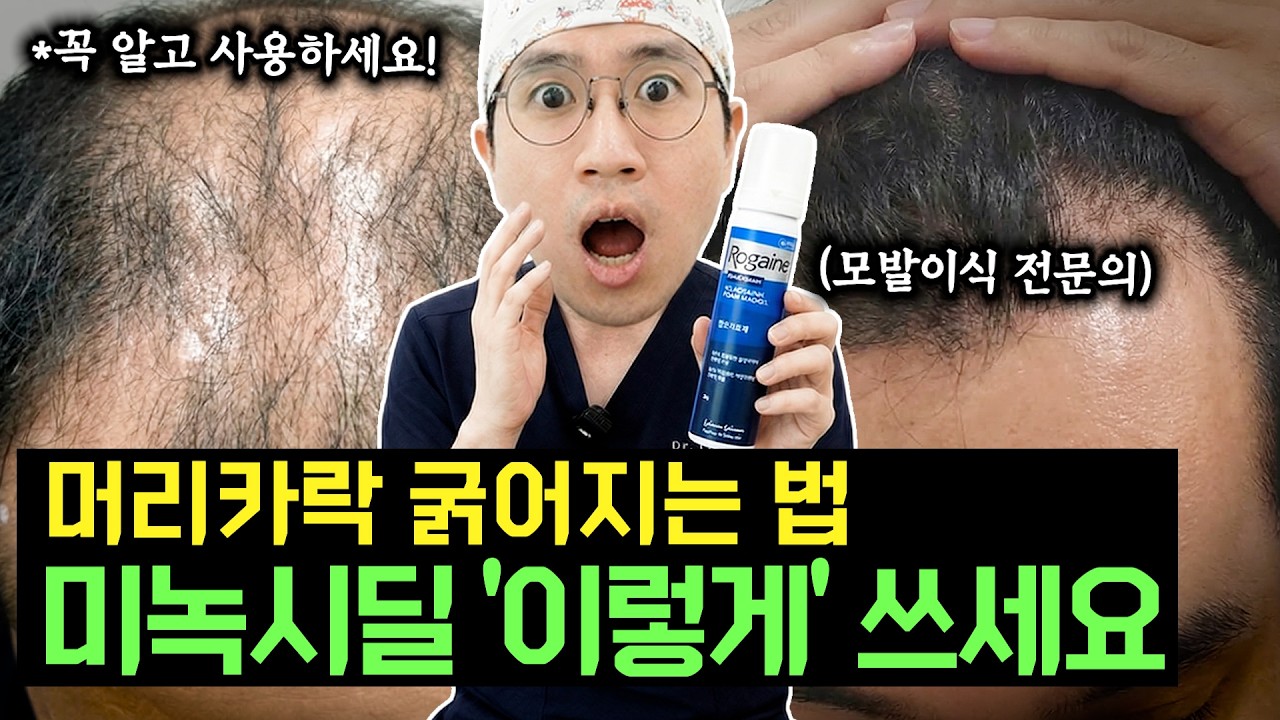 미녹시딜 사용에 대한 거의 모든 답변들 ver.2026