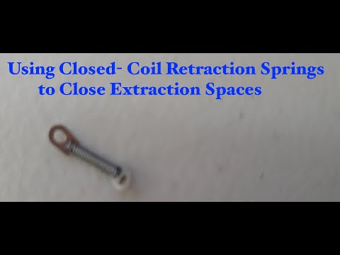 Power Chain Alternative- How to close  Spaces with Closed Coil Retraction / Protraction Springs